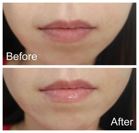 dior lip plumper before after|Dior Lip Maximizer has one unexpected benefit that  .